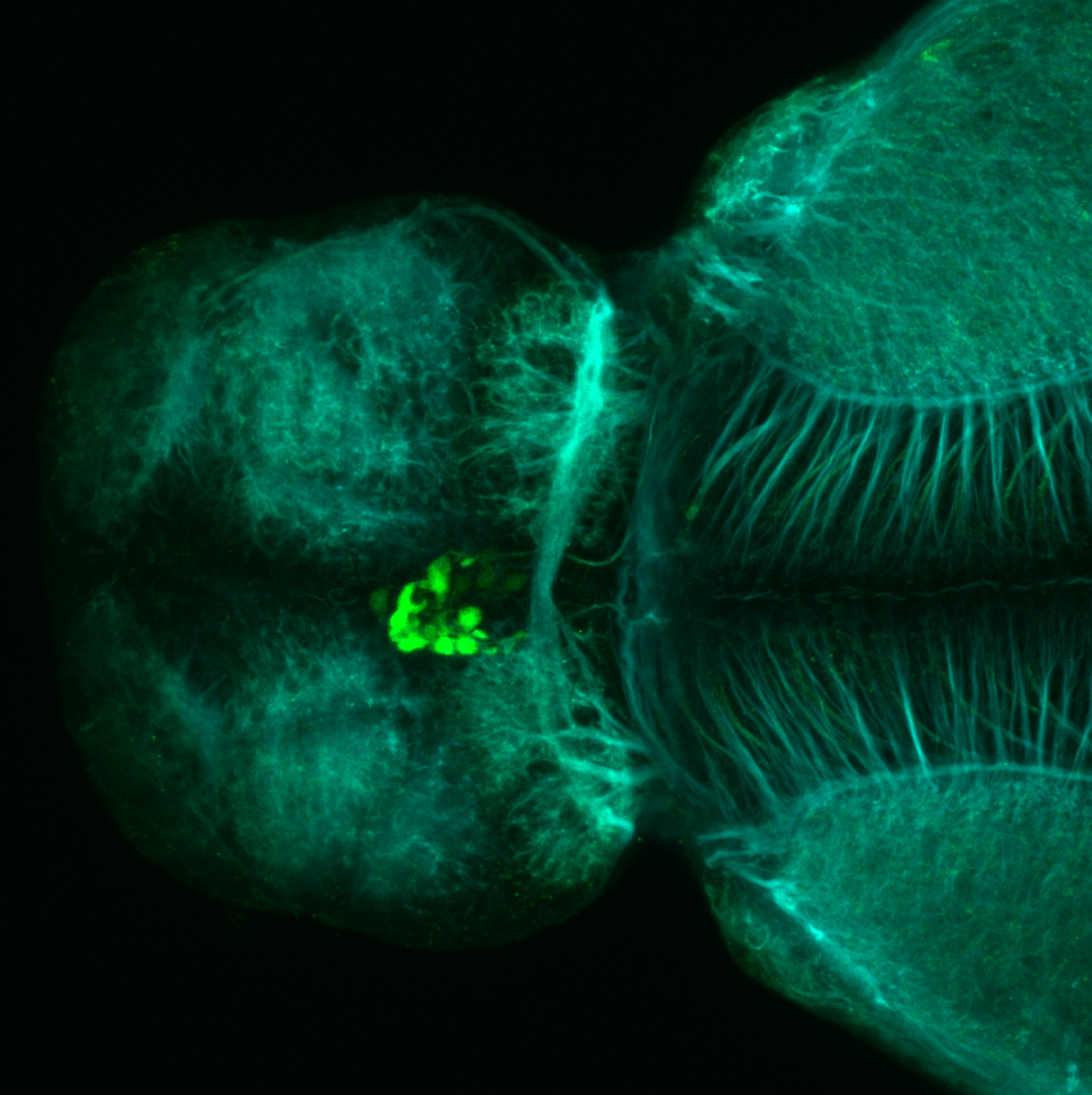 Tg(slc6a5:GFP) dorsal 4dpf with tubulin(cyan)