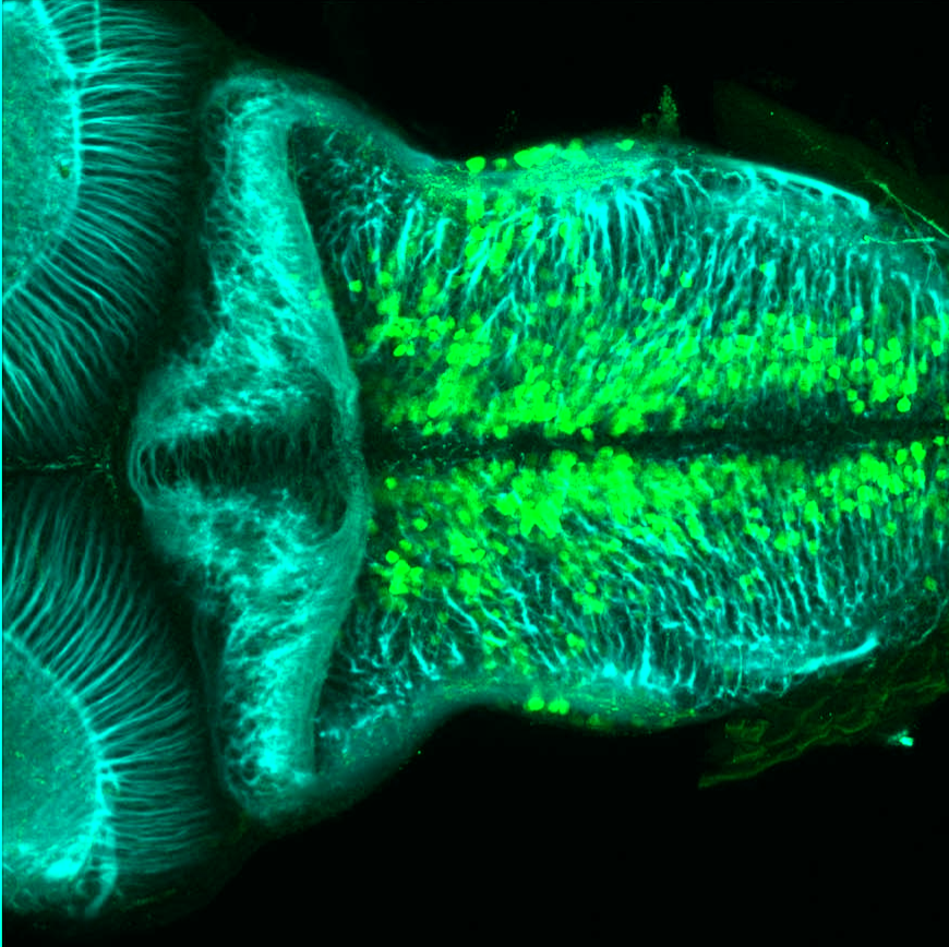 Tg(slc6a5:GFP) dorsal 4dpf hindbrain with tubulin(cyan)