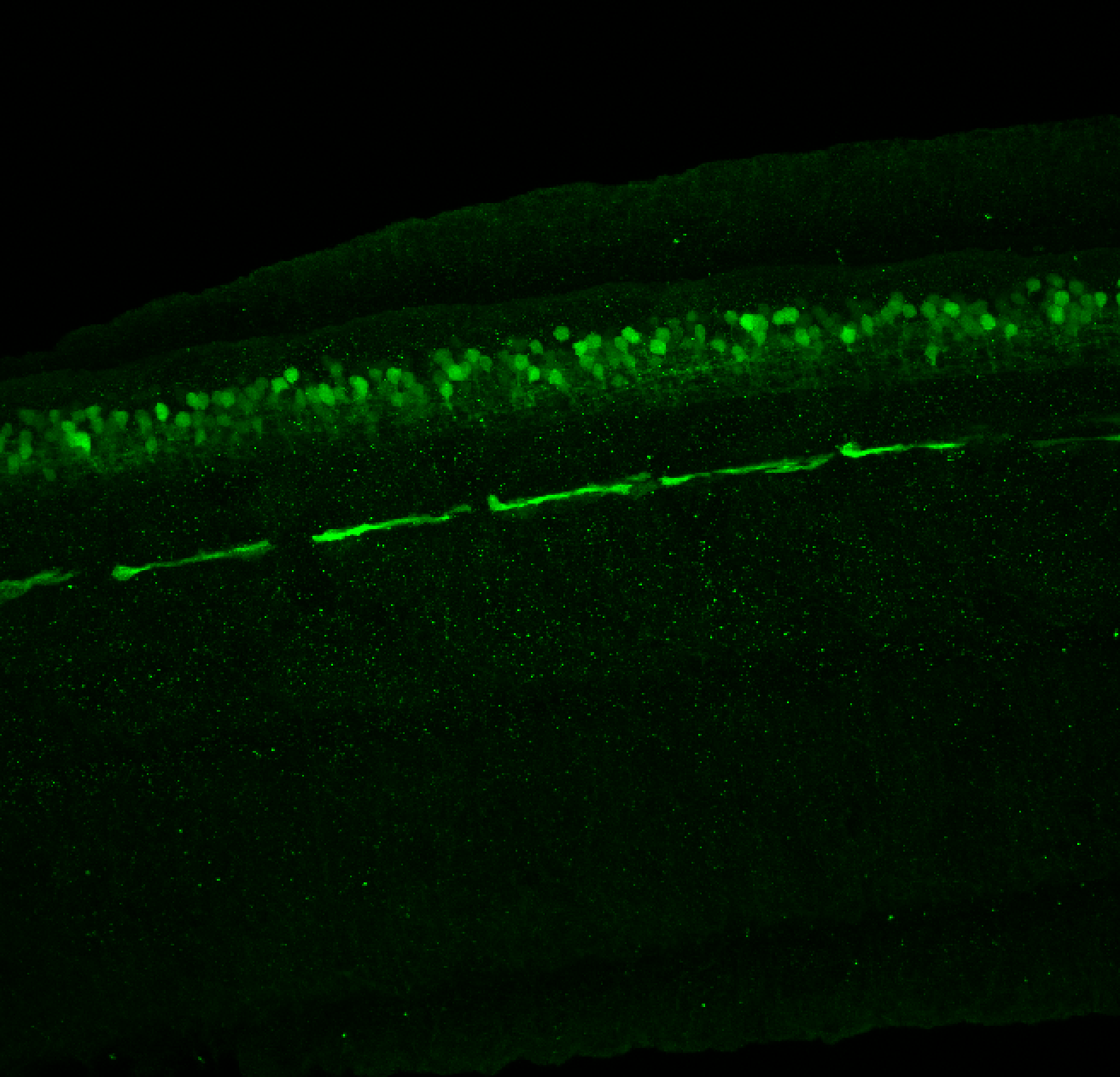 Tg(slc6a5:GFP) lateral 48hpf