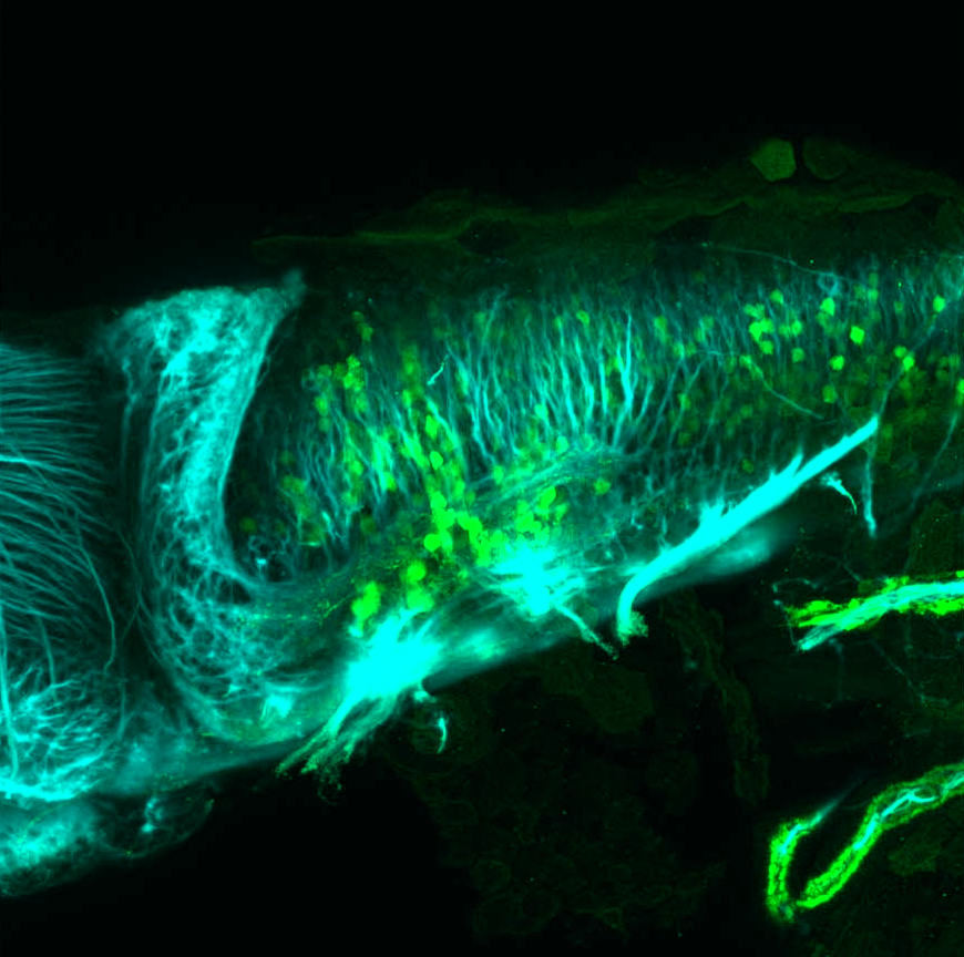 Tg(slc6a5:GFP) lateral 4dpf with tubulin(cyan)