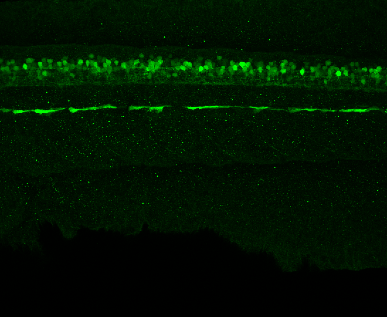 Tg(slc6a5:GFP) lateral 48hpf 