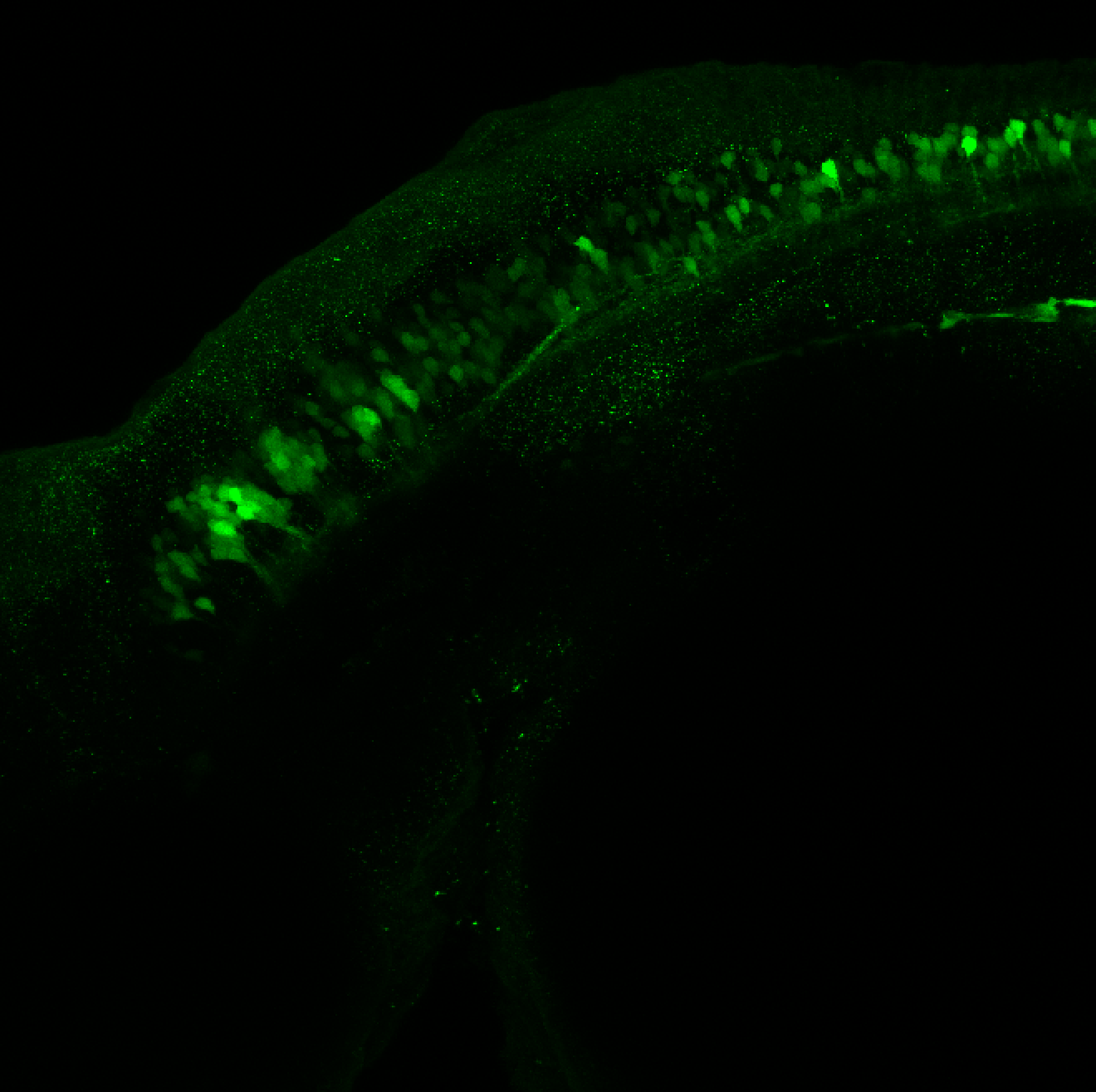 Tg(slc6a5:GFP) dorsal 48hpf 