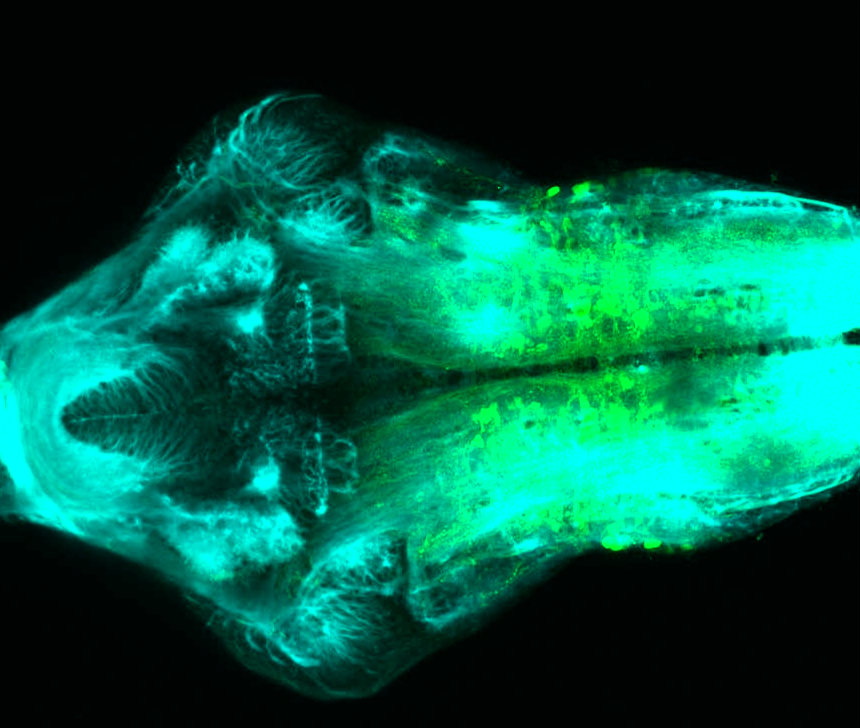 Tg(slc6a5:GFP) ventral 4dpf with tubulin(cyan)