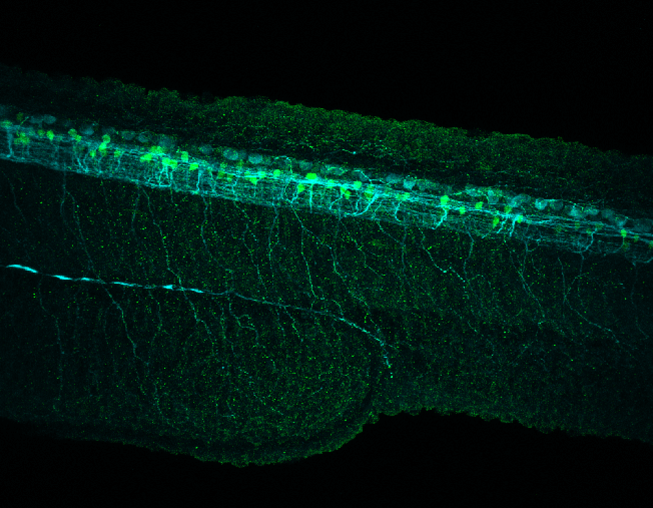 Tg(slc6a5:GFP) lateral 30hpf with tubulin(cyan)