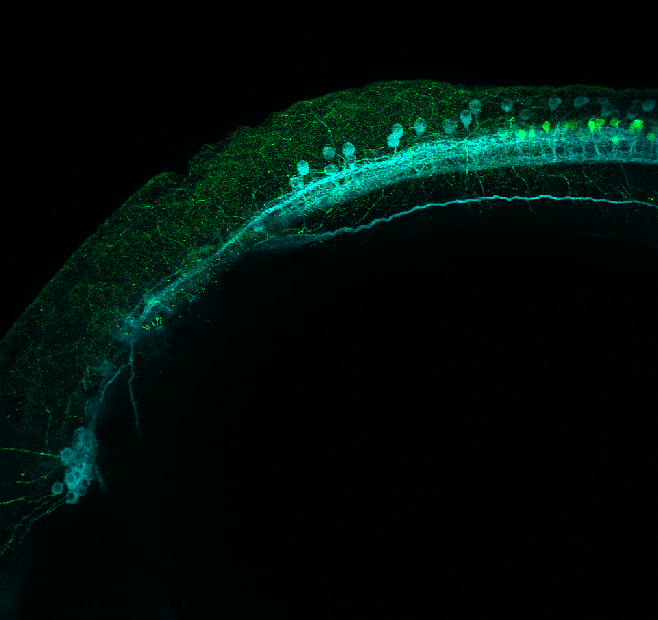 Tg(slc6a5:GFP) Lateral 24hpf