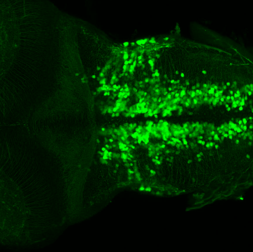 Tg(slc6a5:GFP) dorsal 4dpf hindbrain