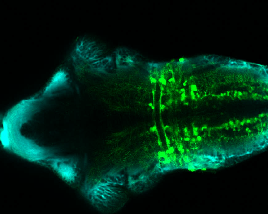 Tg(slc6a5:GFP) ventral 4dpf with tubulin(cyan) 