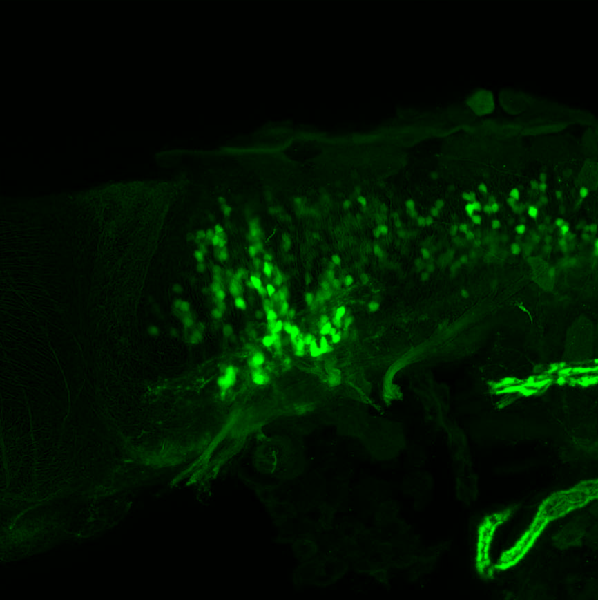 Tg(slc6a5:GFP) lateral 4dpf 