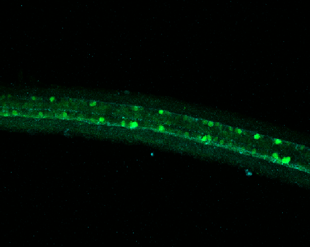 Tg(slc6a5:GFP) dorsal 30hpf with tubulin(cyan)