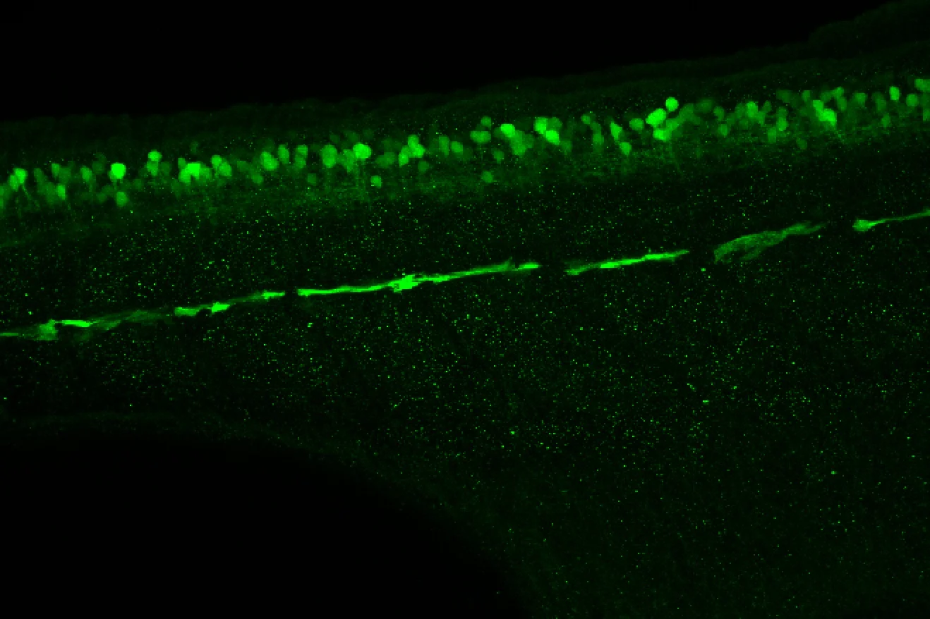 Tg(slc6a5:GFP) lateral 48hpf