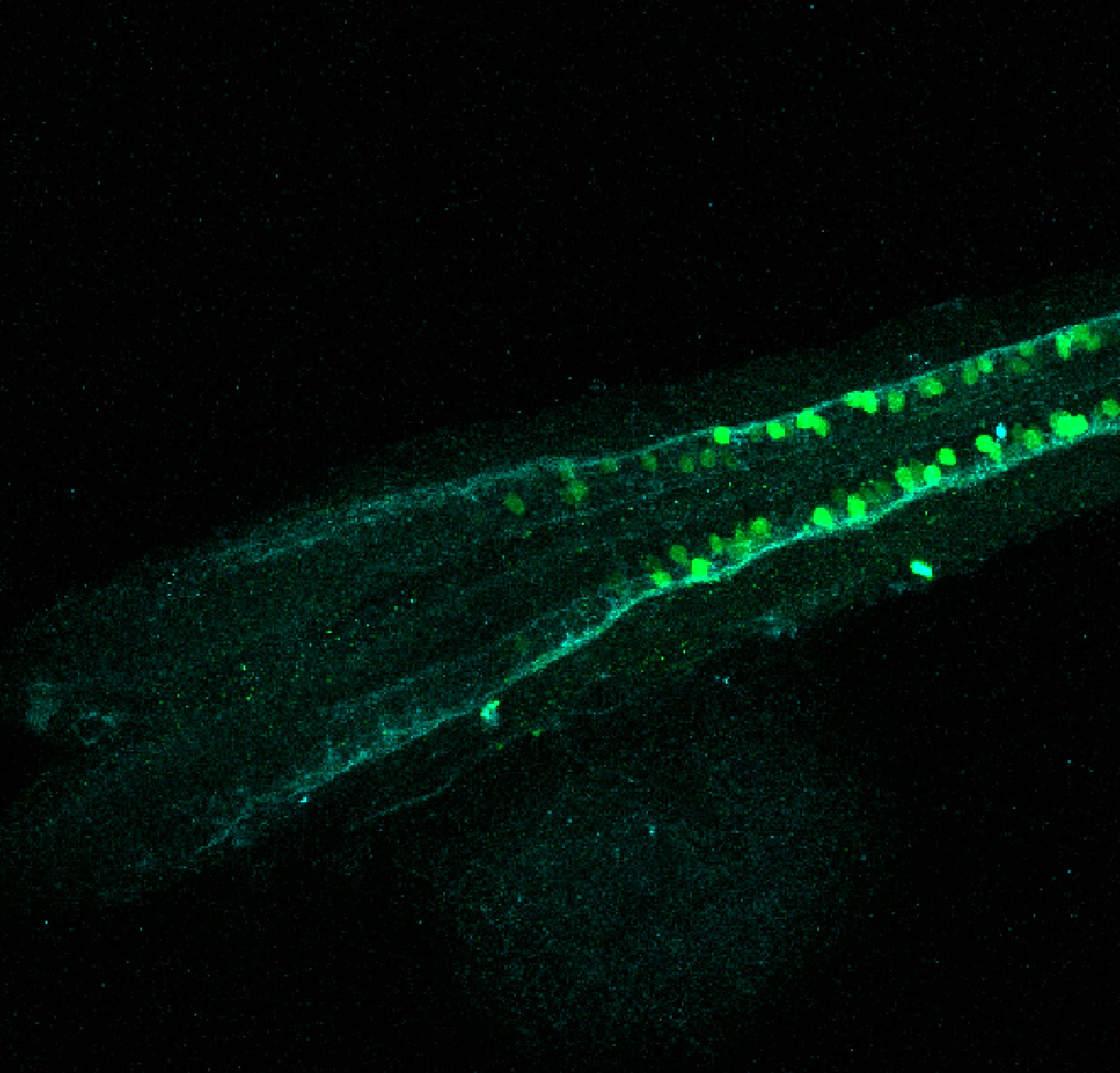 Tg(slc6a5:GFP) dorsal 30hpf with tubulin(cyan)