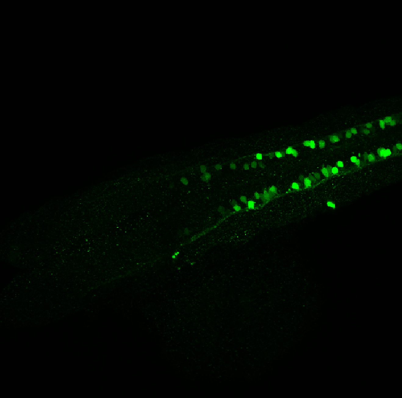 Tg(slc6a5:GFP) dorsal 30hpf 