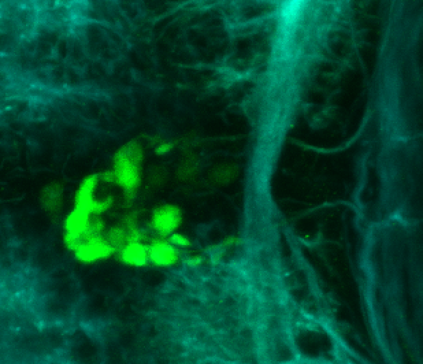 Tg(slc6a5:GFP) dorsal 4dpf with tubulin(cyan)