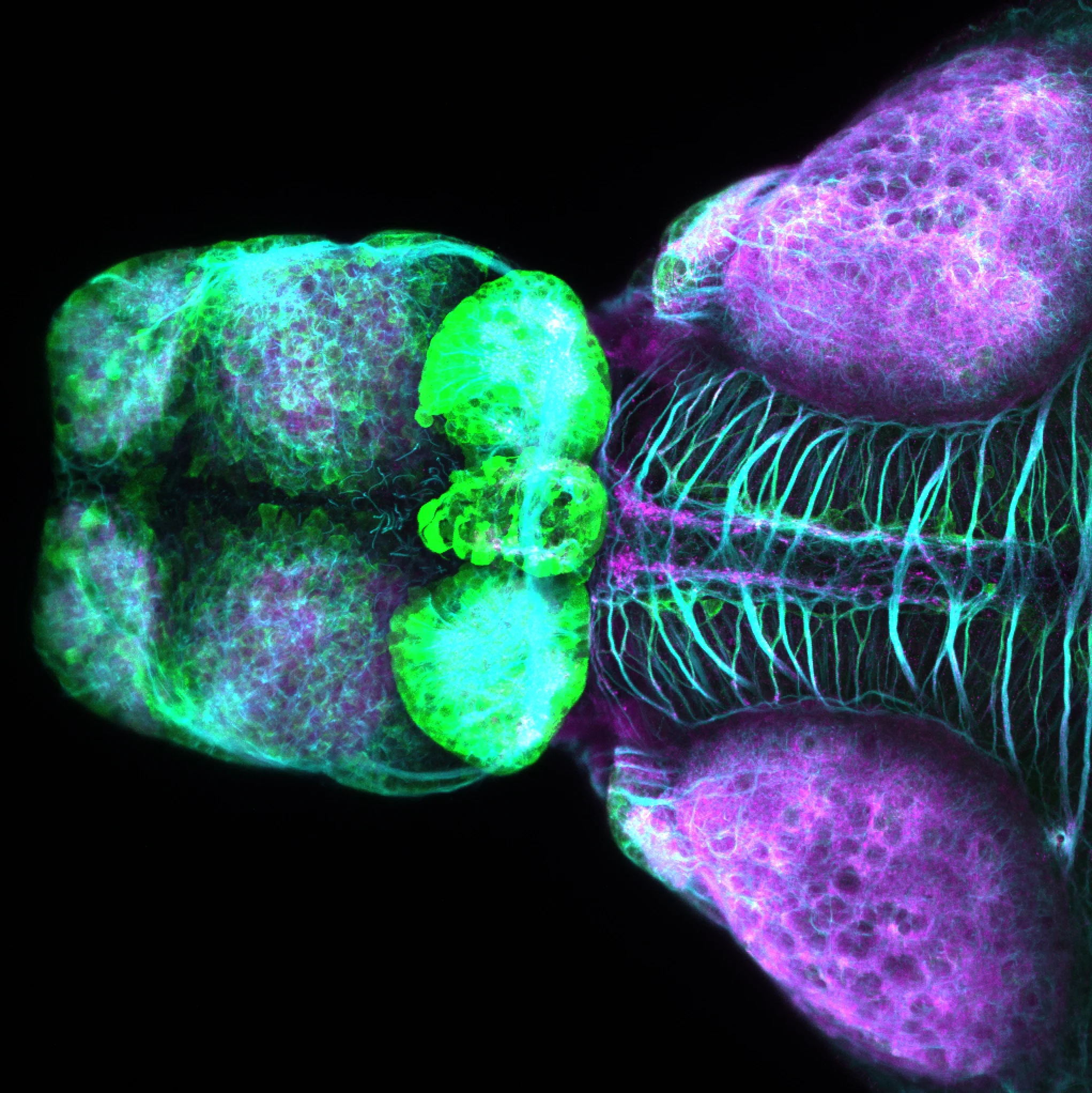 SAGFF(LF)223A dorsal view 4dpf