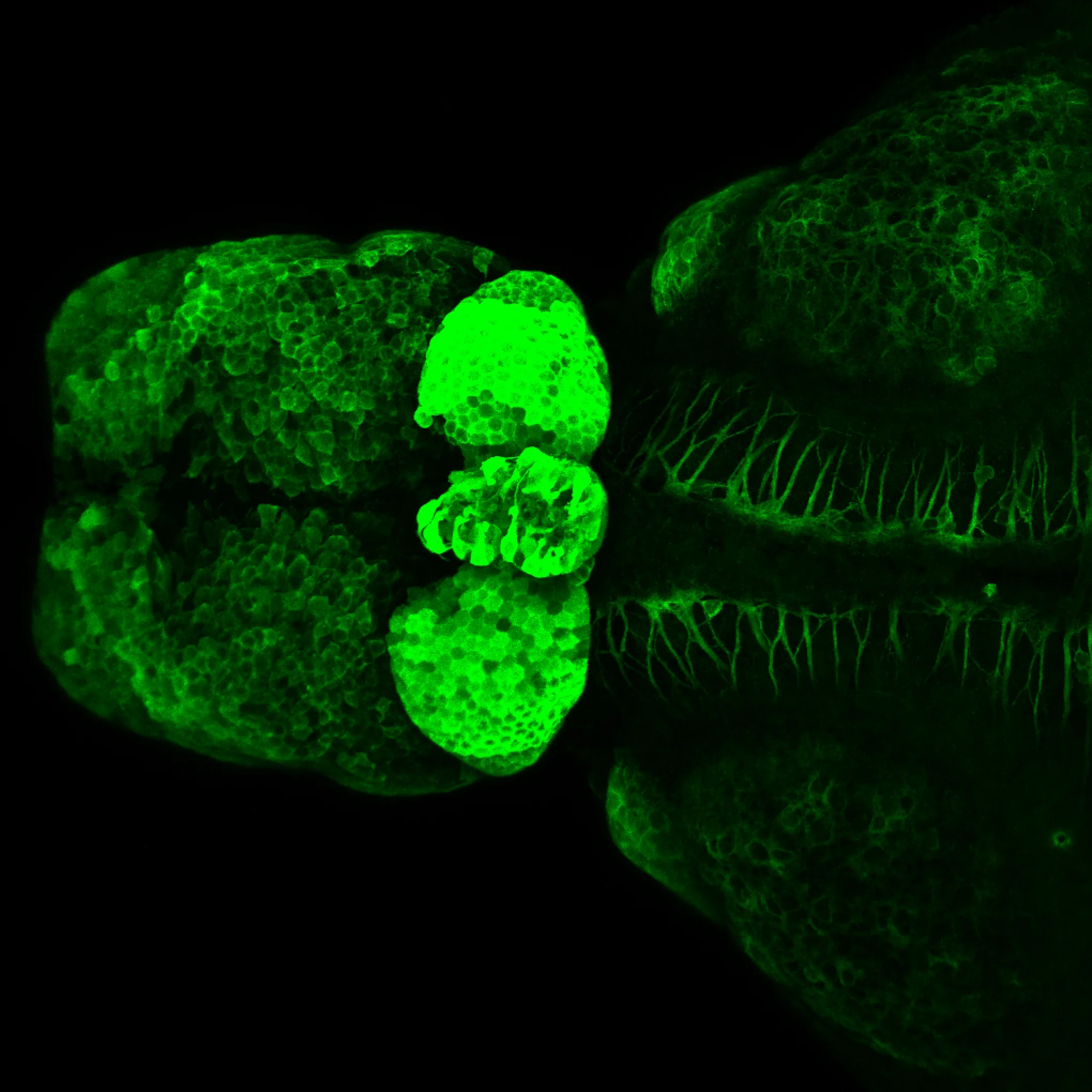 SAGFF(LF)223A dorsal view 4dpf