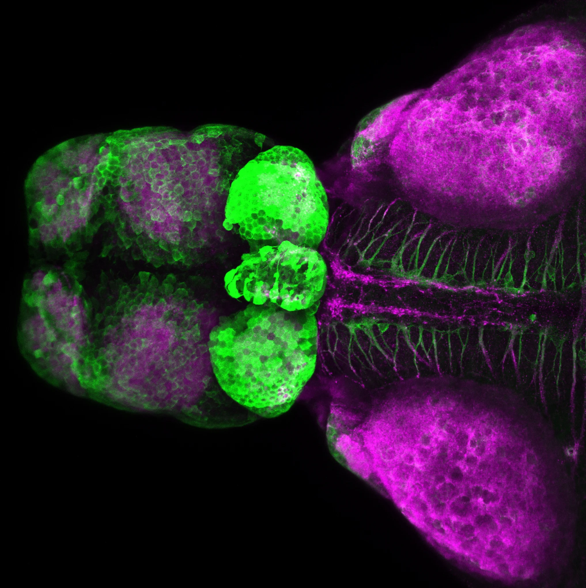 SAGFF(LF)223A dorsal view 4dpf