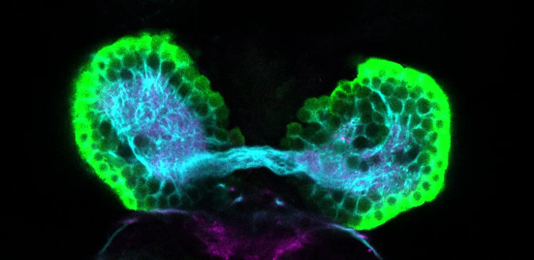 SAGFF(LF)223A dorsal view 4dpf