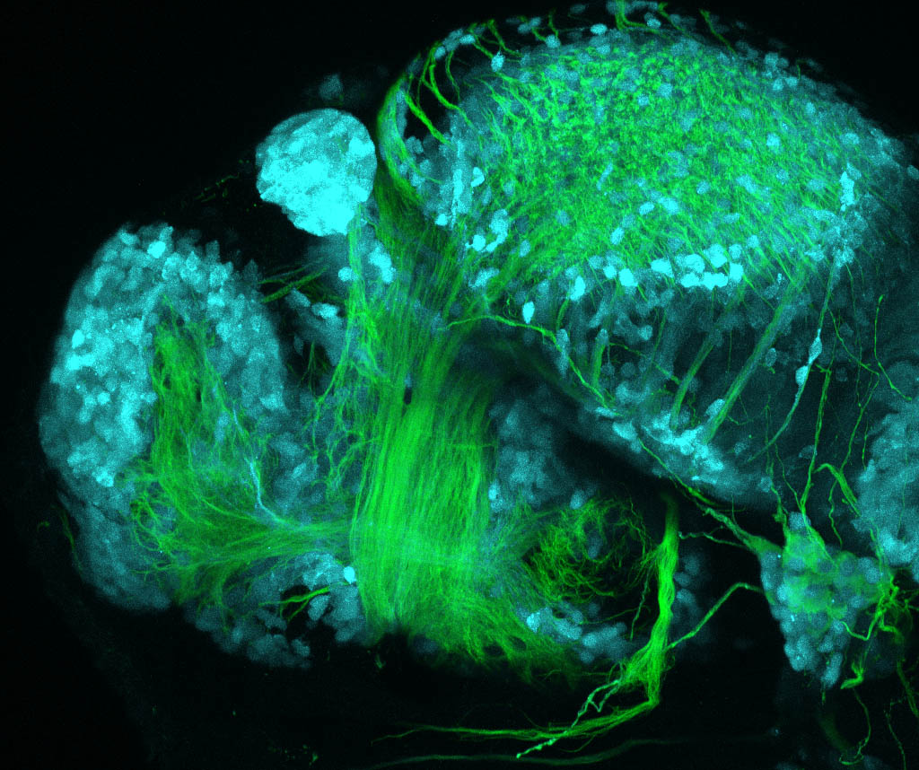 Tg(slc17a6b:DsRed), tubulin 48hpf Lateral