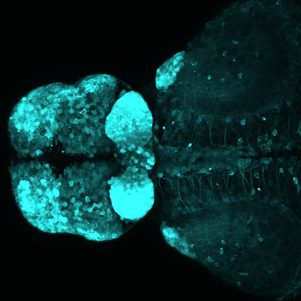 Tg(slc17a6b:DsRed)  4dpf Dorsal