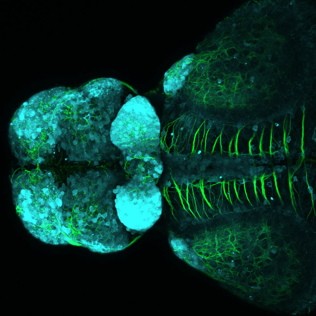 Tg(slc17a6b:DsRed), tubulin  4dpf Dorsal