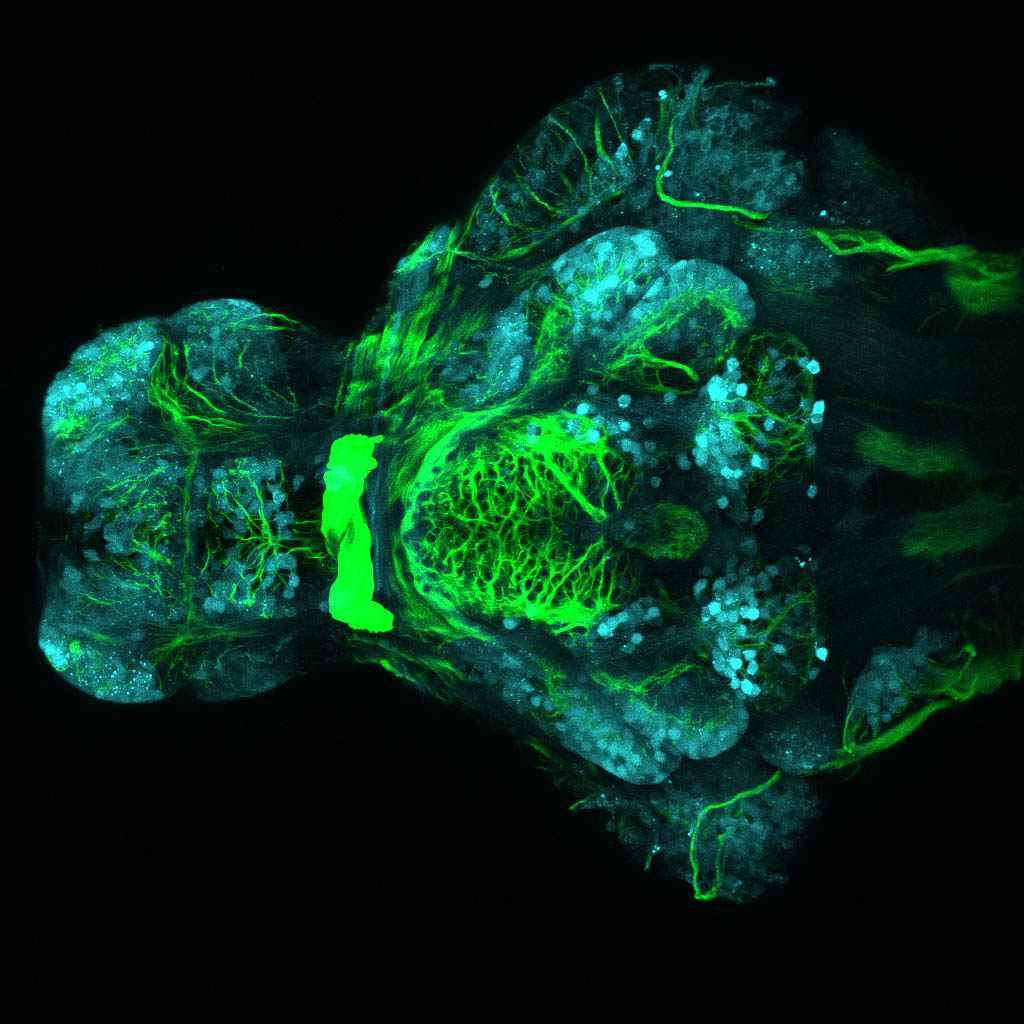 Tg(slc17a6b:DsRed), tubulin 4dpf Ventral