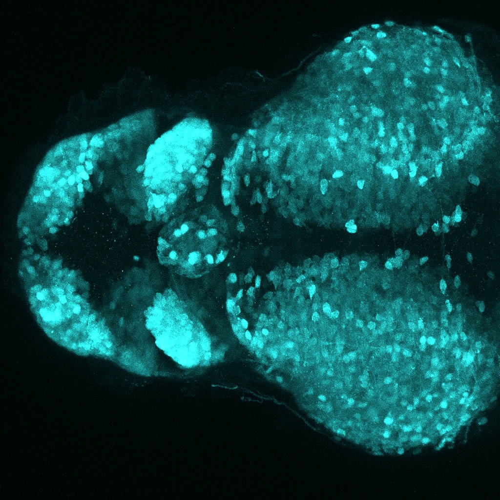 Tg(slc17a6b:DsRed) 48hpf Dorsal