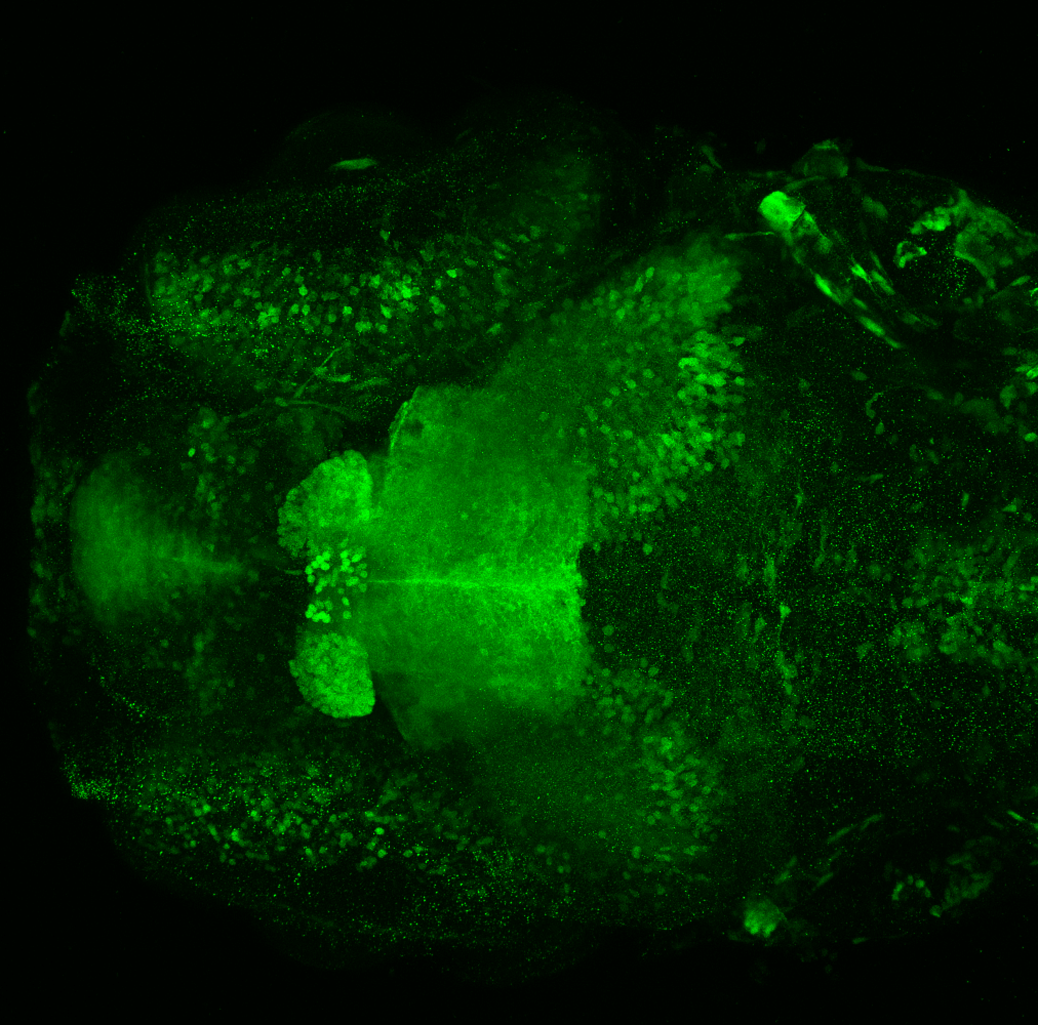 Et(fos:Gal4-VP16)s1026t 4dpf dorsal