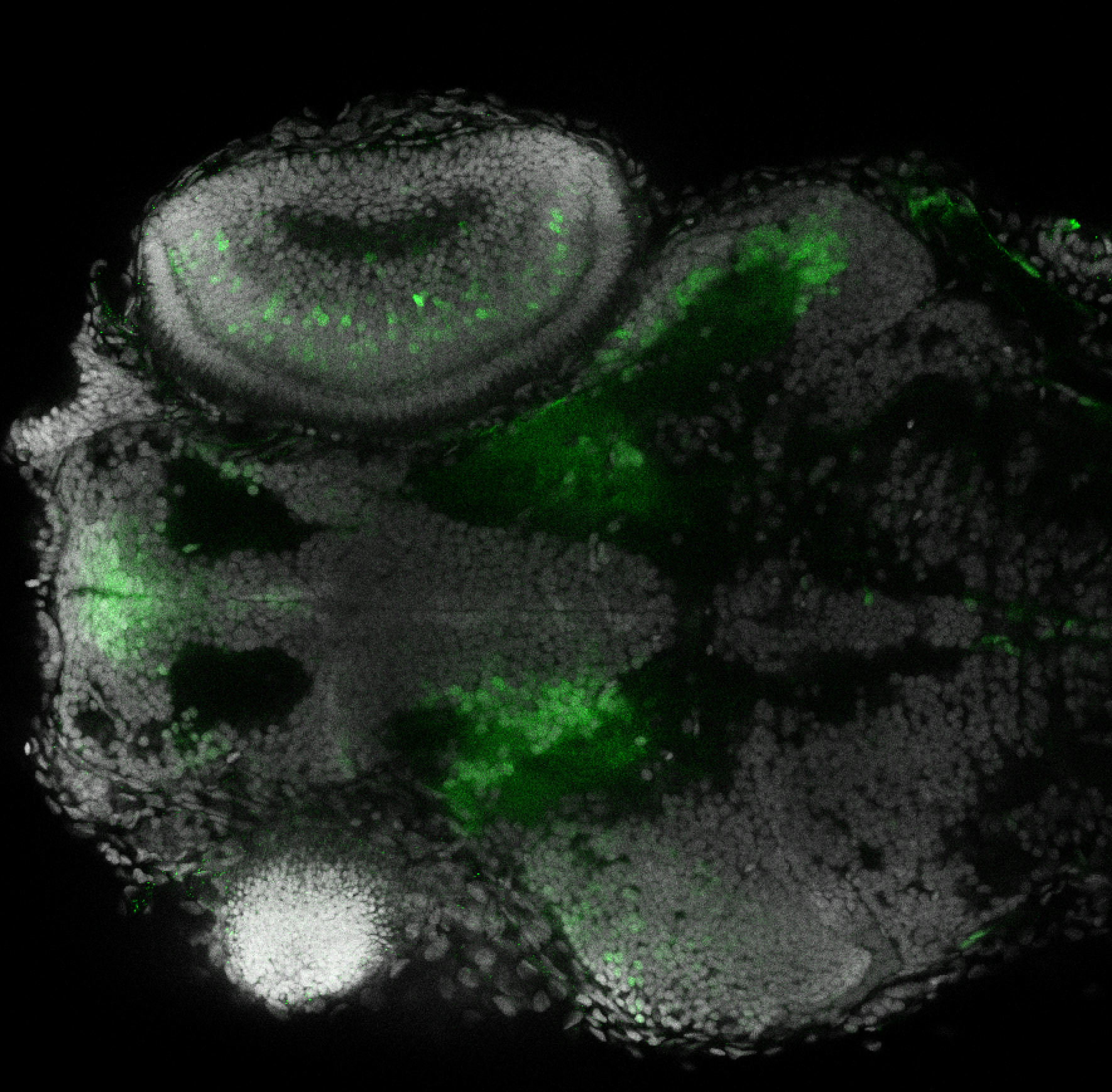 Et(fos:Gal4-VP16)s1026t 4dpf dorsal with nuclear marker(grey). 