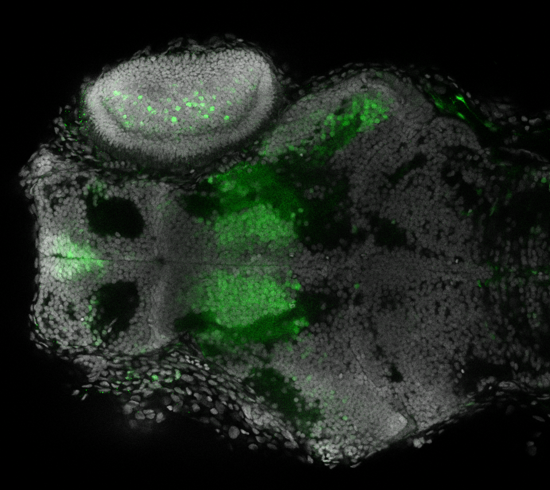 Et(fos:Gal4-VP16)s1026t 4dpf dorsal with nuclear marker(grey). 