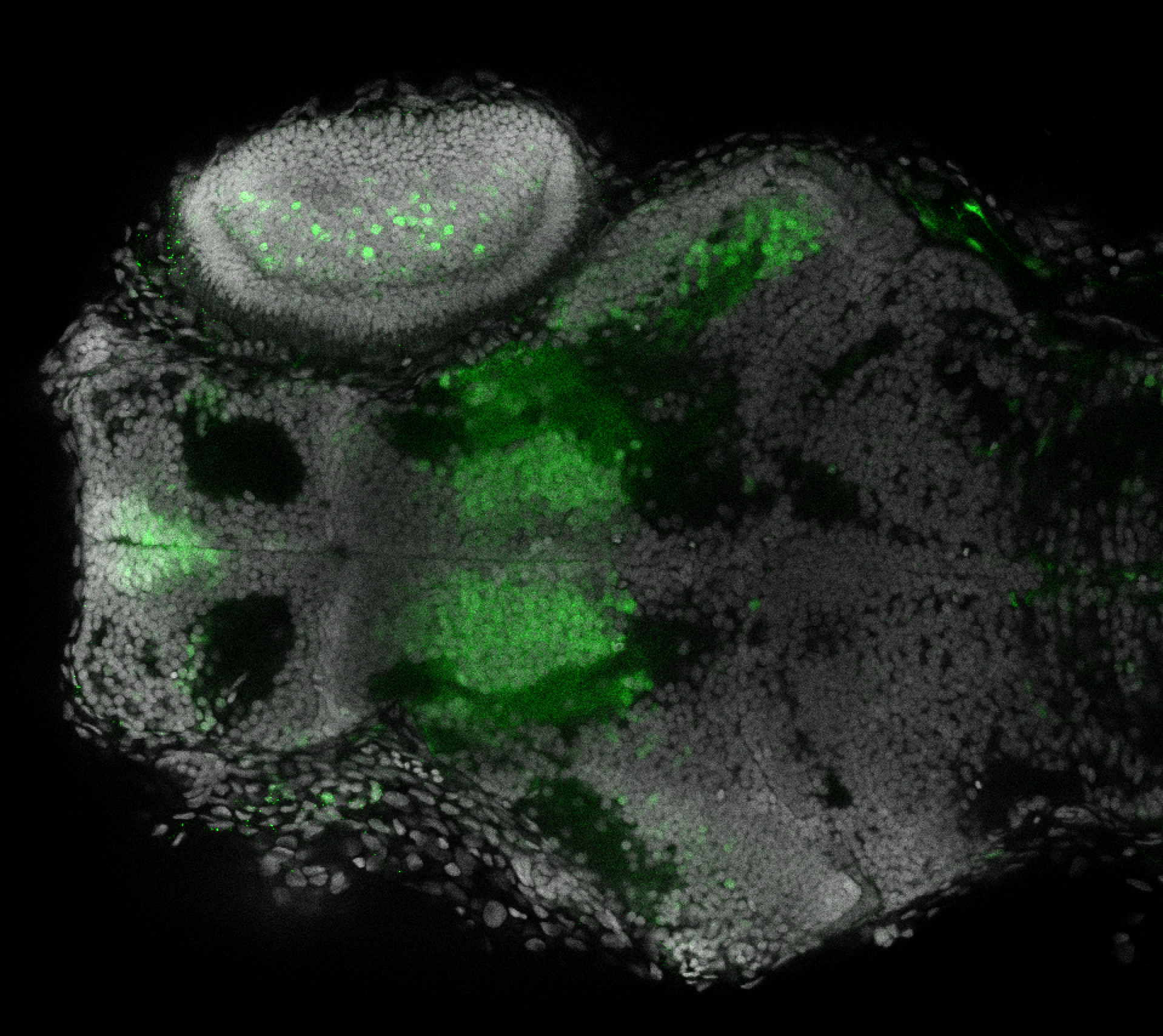 Et(fos:Gal4-VP16)s1026t 4dpf dorsal with nuclear marker(grey).