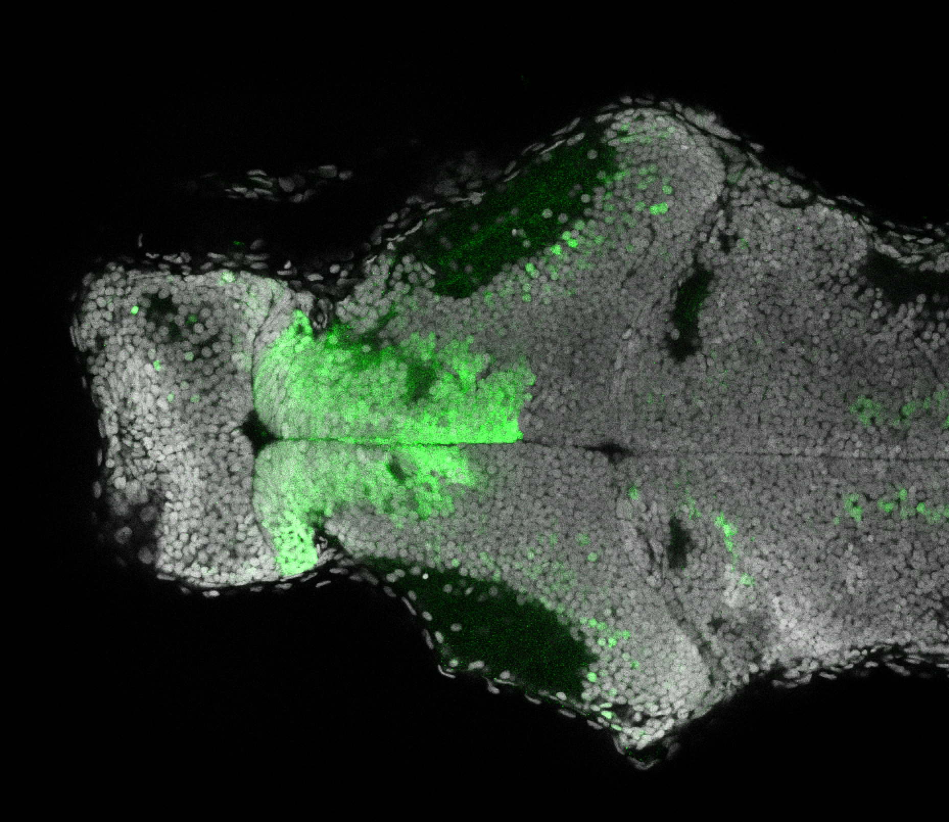 Et(fos:Gal4-VP16)s1026t 4dpf dorsal with nuclear marker(grey). 