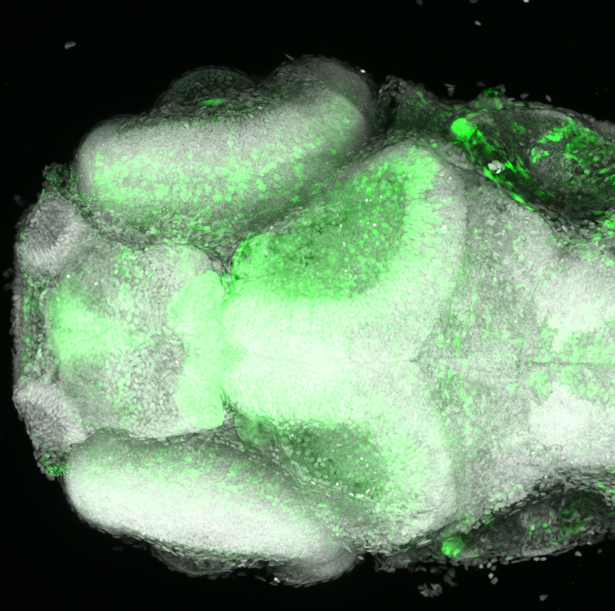 Et(fos:Gal4-VP16)s1026t 4dpf dorsal with nuclear marker TOTO-3(grey). 