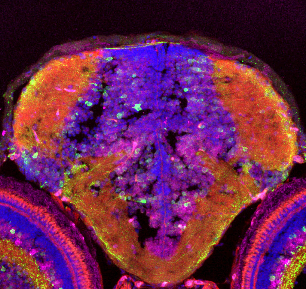 The retina connects to the visual centres in the brain