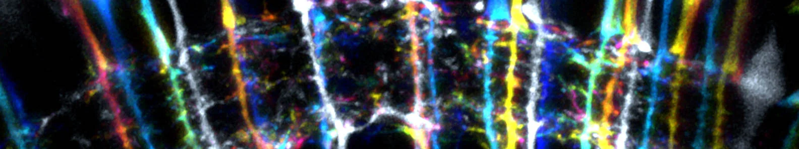 The inner plexiform layer