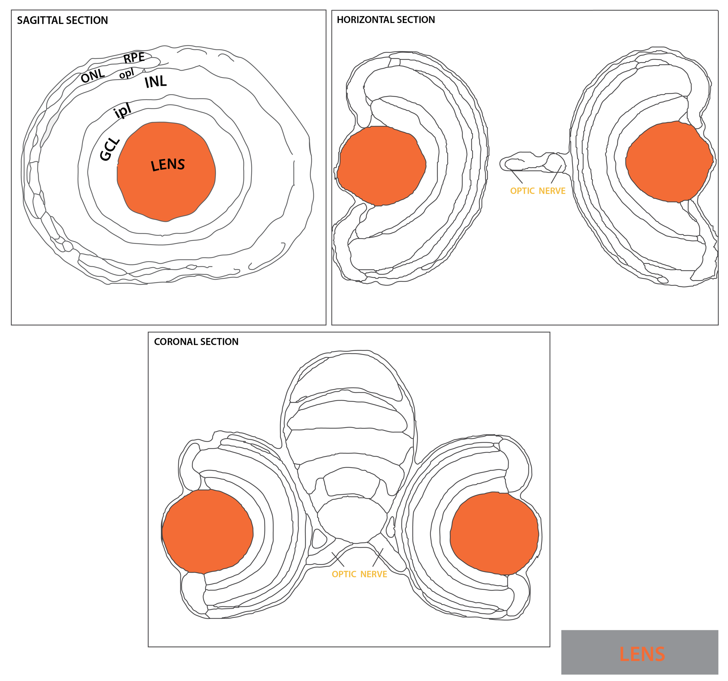 Schematic showing the position of the lens in sagittal, horizontal and coronal sections through the zebrafish brain. Based on the anatomical segmentation of 3 day old zebrafish larval brain by Thomas Müller, Olaf Ronneberger, Wolfgang Driever and colleagues. For details see Ronneberger et al., Nat. Meth. 2012 and http://vibez.informatik.uni-freiburg.de Abbreviations: GCL, ganglion cell layer; INL, inner nuclear layer ; ipl, inner plexiform layer ; ONL, outer nuclear layer ; opl, outer plexiform layer; RPE, retinal pigmented epithelium.