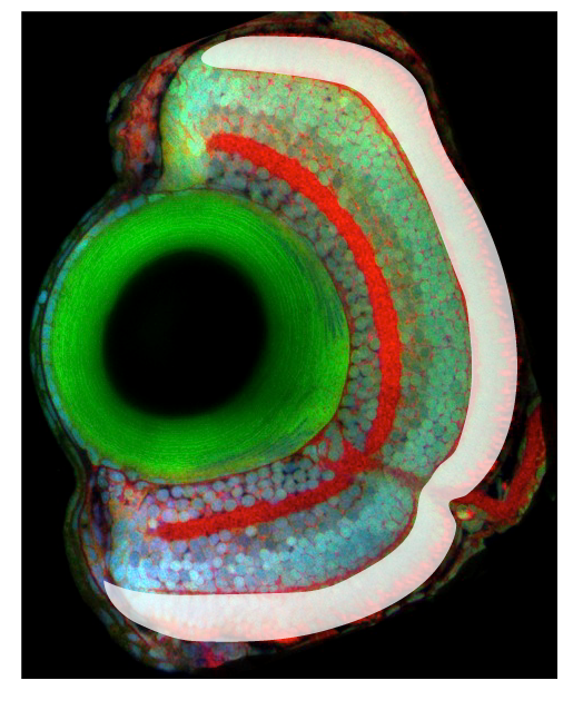 outer Nuclear Layer