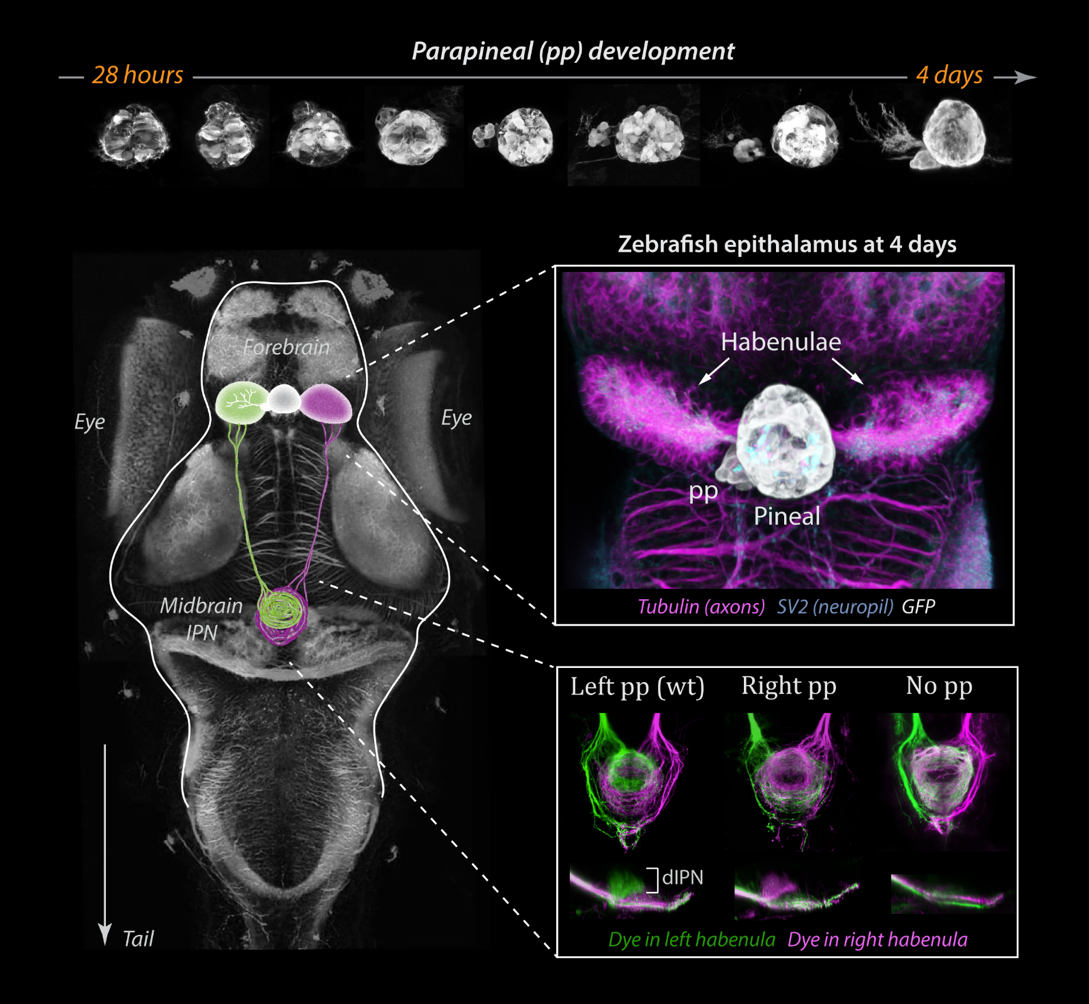 Figure 1: The parapineal emerges from the pineal during zebrafish embryogenesis, as shown by confocal images of a transgenic line with GFP in the pineal complex (top pictures). The pineal complex lies at the midline of the epithalamus, flanked by left (green on the scheme) and right (magenta on the scheme) habenulae. The habenulae are innervated by the parapineal and themselves send neuronal projections to the midbrain interpeduncular nucleus (IPN). The side of the parapineal, on the left in wild-type (wt), determines which habenula acquires a left-type identity projecting to the dorsal part of the IPN (dIPN).