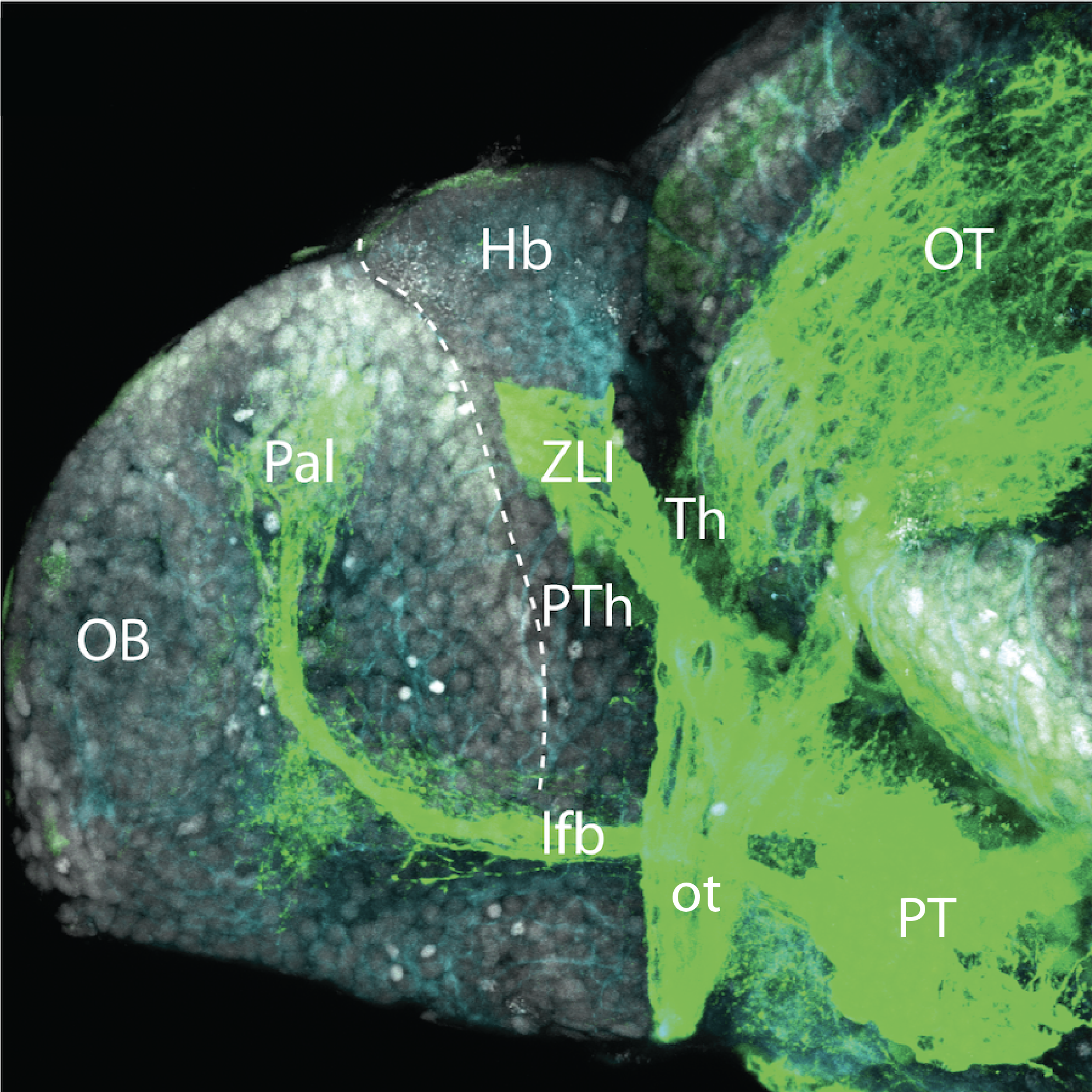 4dpf lateral shh:GFP with acetylated tubulin(cyan) and sytox(grey) 