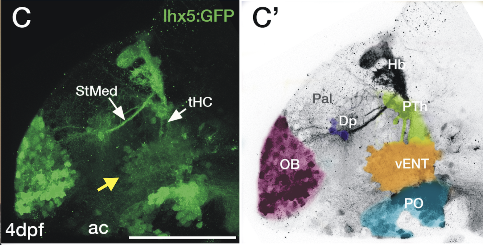 Tg(lhx5:GFP) 4dpf lateral view