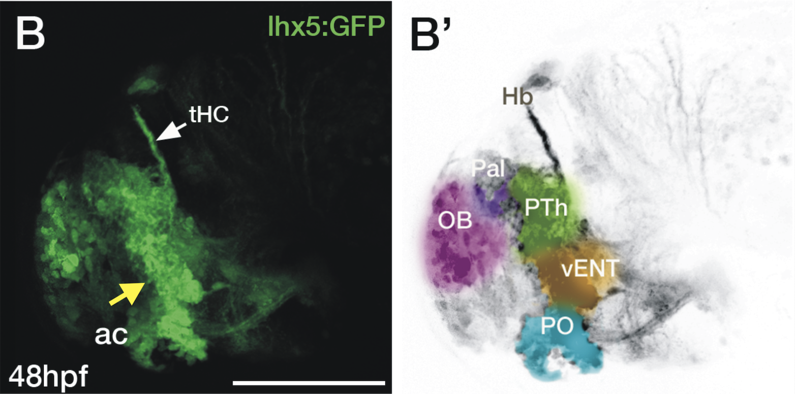 Tg(lhx5:GFP) lateral view 48hpf.