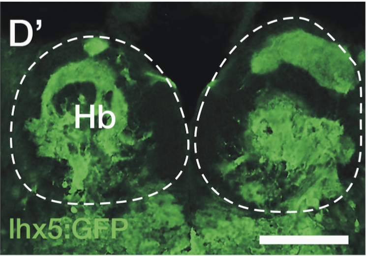 transverse section through the habenula of an adult Tg(lhx5:GFP) zebrafish
