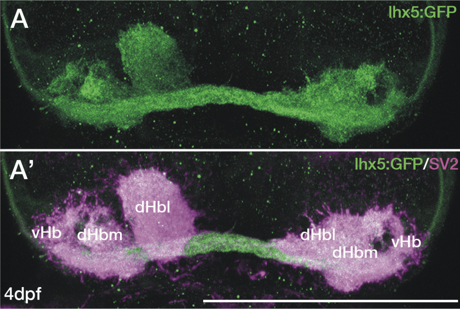Dorsal view of the habenula in a 4dpf Tg(lhx5:GFP) larva.
