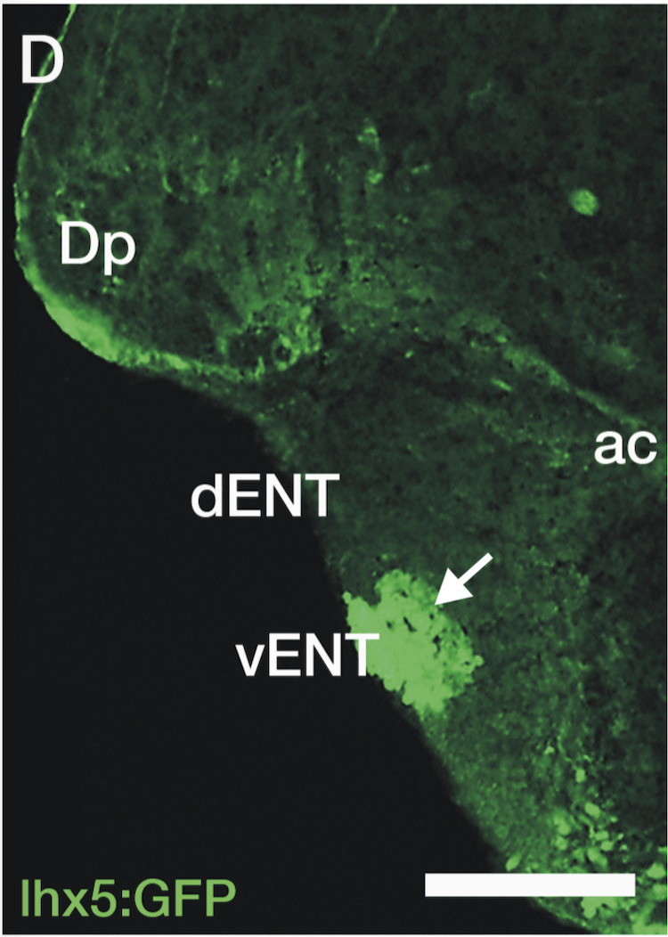 transverse section through the telencephalon of a Tg(lhx5:GFP) zebrafish.