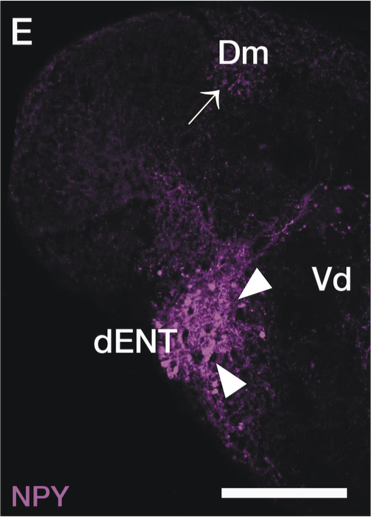 transverse section through adult telencephalon labelled with anti-NPY antibody.