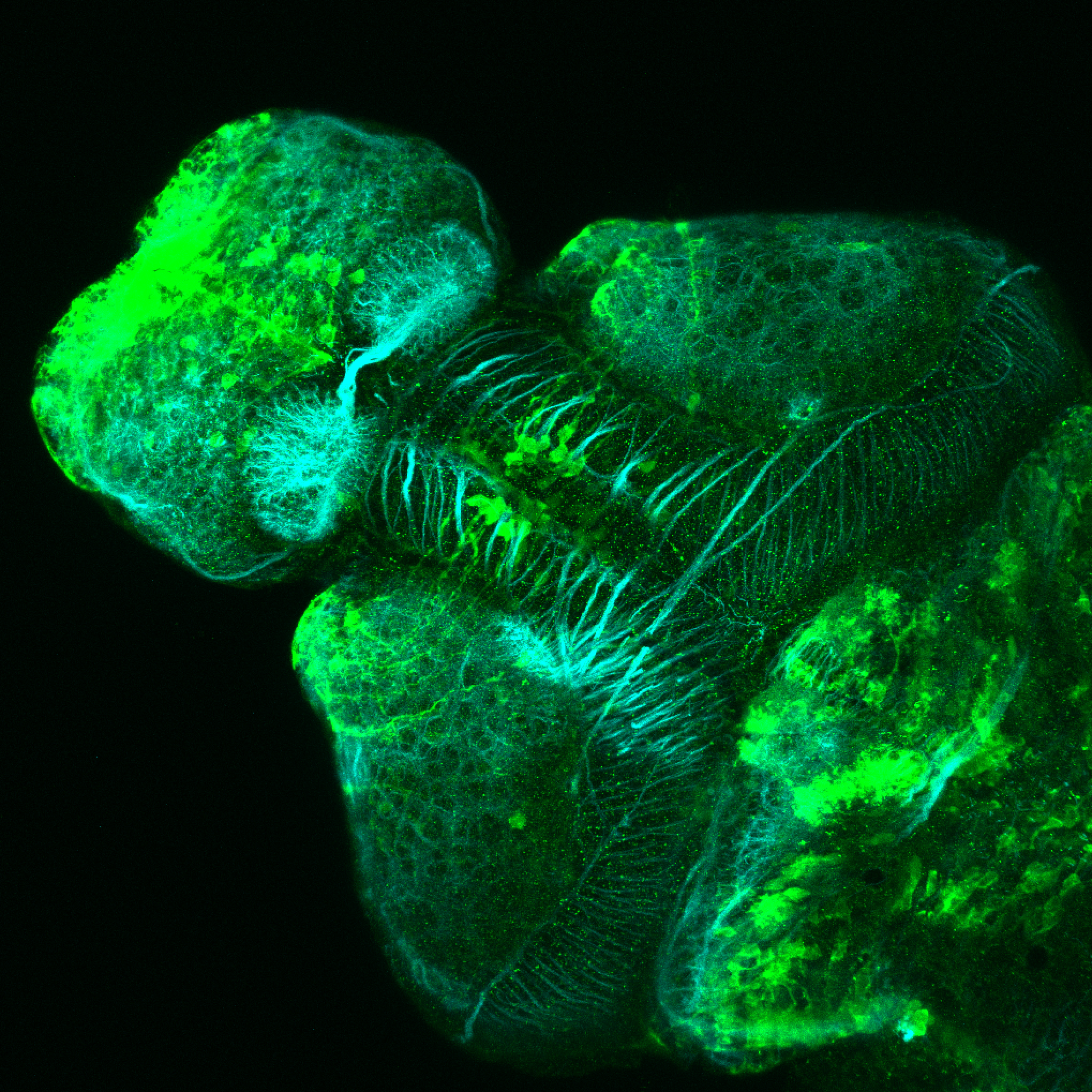 Et(CLG-YFP)smb750Et 4dpf dorsal with acetylated tubulin(cyan). 