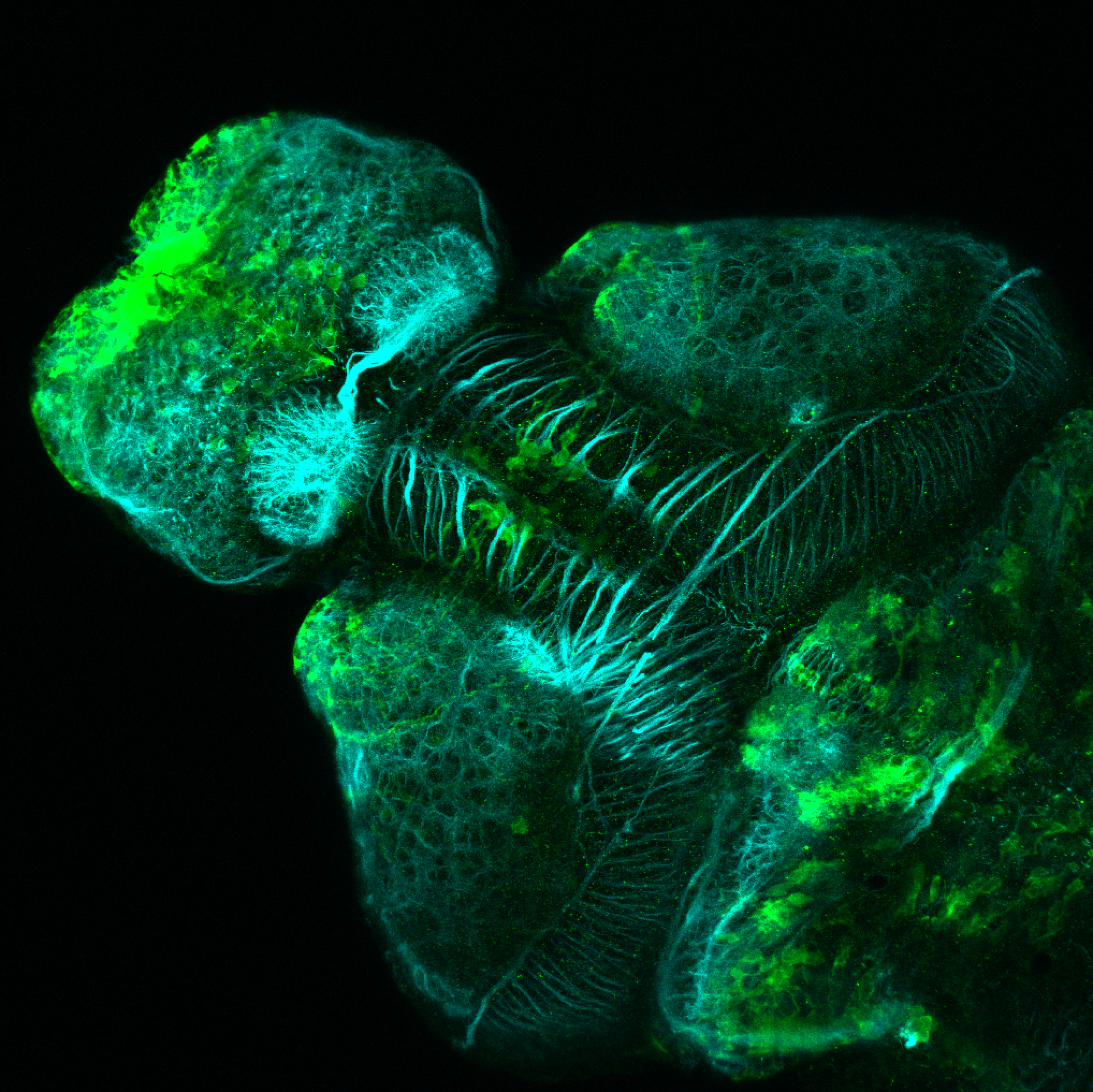 Et(CLG-YFP)smb750Et 4dpf dorsal with acetylated tubulin(cyan).
