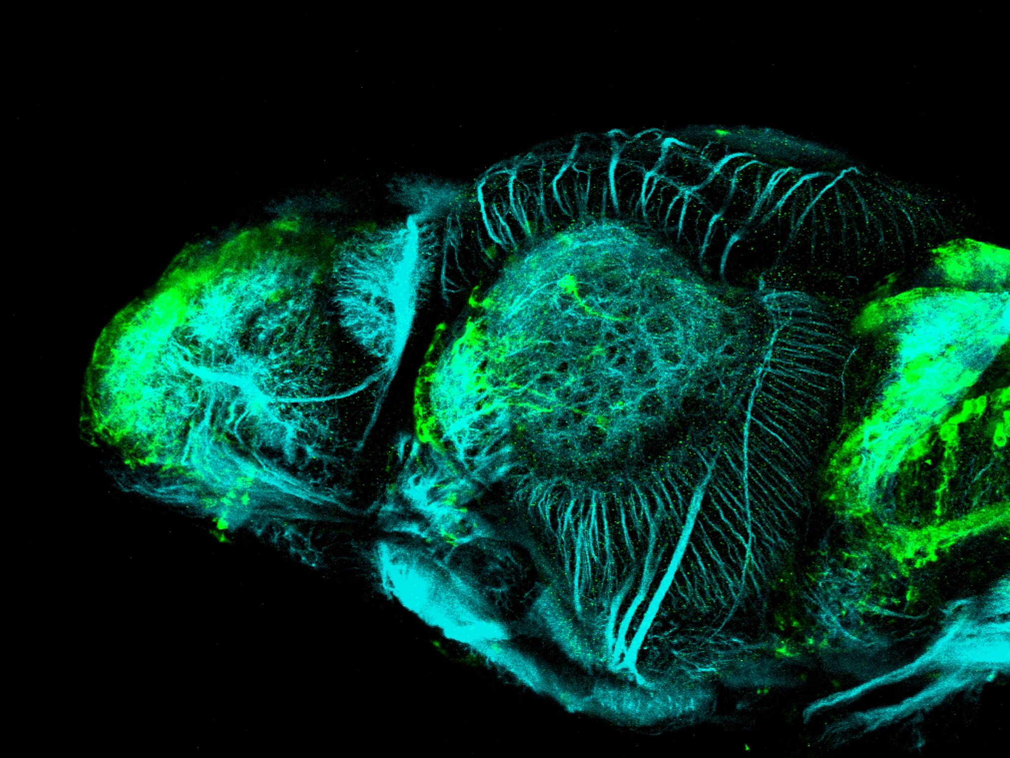 Et(CLG-YFP)smb750Et 4dpf lateral with acetylated tubulin(cyan). 