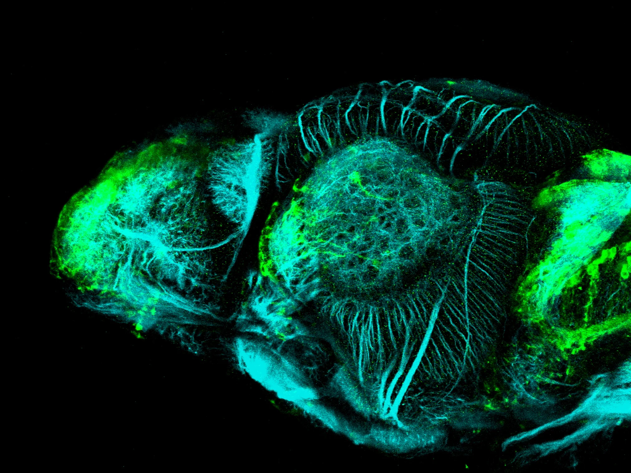 Et(CLG-YFP)smb750Et 4dpf lateral with acetylated tubulin(cyan).