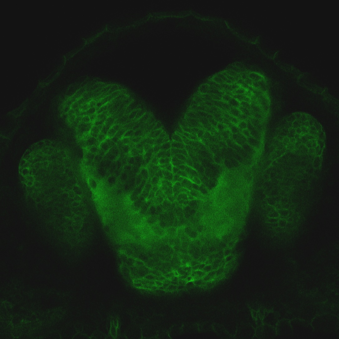 Tg(-8.0cldnb:lynGFP)zf106 2dpf frontal transverse section through the telencephalon