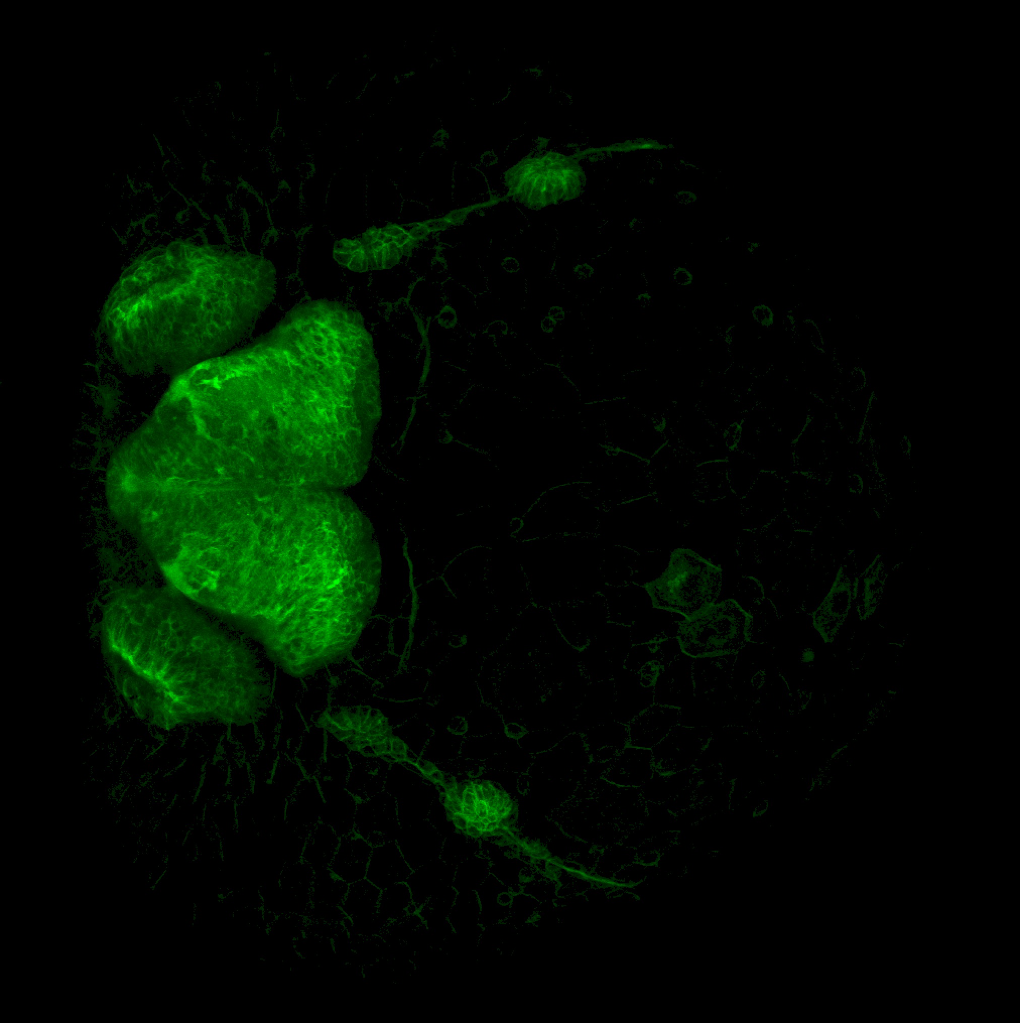 Tg(-8.0cldnb:lynGFP)zf106 2dpf dorsal